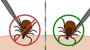 How to Remove a Tick